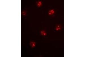 Immunofluorescent analysis of MCM6 staining in Hela cells. (MCM6 抗体)