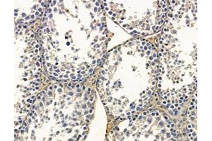 ABIN7095167 and ABIN7099223 at 1/100 staining mouse testis tissue by IHC-P. (FBXL7 抗体)