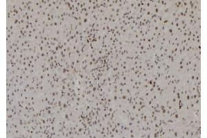 ABIN6277200 at 1/100 staining Rat liver tissue by IHC-P. (Histone 3 抗体  (H3K27me3))