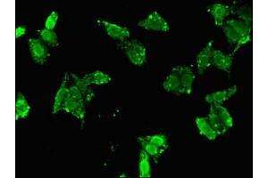 Immunofluorescent analysis of HepG2 cells using ABIN7153390 at dilution of 1:100 and Alexa Fluor 488-congugated AffiniPure Goat Anti-Rabbit IgG(H+L) (Cyclin D2 抗体  (AA 215-285))