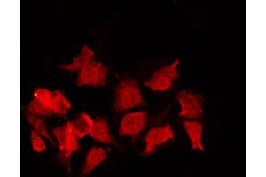 ABIN6267380 staining NIH-3T3 by IF/ICC. (Cyclin B1 抗体  (pSer147))