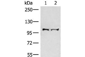 Western blot analysis of Mouse brain tissue and Jurkat cell lysates using EFTUD2 Polyclonal Antibody at dilution of 1:550 (EFTUD2 抗体)