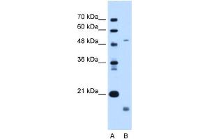 WB Suggested Anti-ZMPSTE24 Antibody Titration:  0. (ZMPSTE24 抗体  (N-Term))