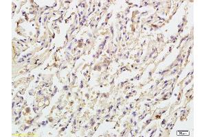 Formalin-fixed and paraffin embedded human endometrial tissue labeled with Anti Caspase-9 p10 Polyclonal Antibody, Unconjugated (ABIN1387603) at 1:200 followed by conjugation to the secondary antibody and DAB staining (Caspase 9 抗体  (AA 351-416))