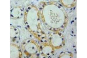 IHC-P analysis of Kidney tissue, with DAB staining. (Nephrin 抗体  (AA 39-144))