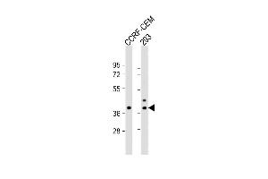 All lanes : Anti-CCD Antibody (C-term) at 1:1000 dilution Lane 1: CCRF-CEM whole cell lysate Lane 2: 293 whole cell lysate Lysates/proteins at 20 μg per lane. (CCDC122 抗体  (C-Term))