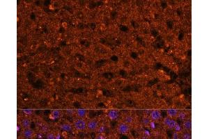 Immunofluorescence (IF) image for anti-3-Hydroxy-3-Methylglutaryl-CoA Synthase 2 (Mitochondrial) (HMGCS2) antibody (ABIN7257752)