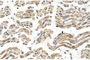 Human Muscle (ALDH4A1 抗体  (C-Term))