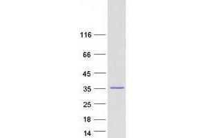 Western Blotting (WB) image for Zinc Finger, AN1-Type Domain 1 (ZFAND1) protein (Myc-DYKDDDDK Tag) (ABIN2735837)