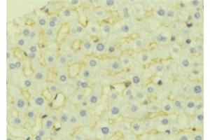 ABIN6277044 at 1/100 staining Mouse liver tissue by IHC-P. (AK4 抗体  (Internal Region))