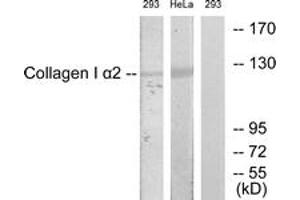 Western blot analysis of extracts from 293/HeLa cells, using Collagen I alpha2 Antibody. (COL1A2 抗体  (AA 471-520))