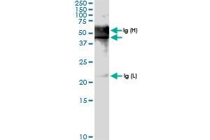 Immunoprecipitation of PDCD2 transfected lysate using anti-PDCD2 MaxPab rabbit polyclonal antibody and Protein A Magnetic Bead , and immunoblotted with PDCD2 MaxPab rabbit polyclonal antibody (D01) . (PDCD2 抗体  (AA 1-344))