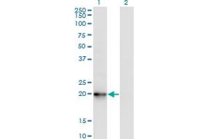 Western Blot analysis of COMMD1 expression in transfected 293T cell line by COMMD1 monoclonal antibody (M03), clone 2B12. (COMMD1 抗体  (AA 1-190))