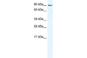 WB Suggested Anti-EPLIN Antibody Titration:  0. (LIMA1 抗体  (Middle Region))