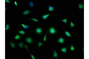 Immunofluorescence staining of SH-SY5Y cells with ABIN7165023 at 1:133, counter-stained with DAPI. (MLLT11 抗体  (AA 1-90))