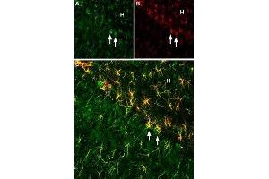 Expression of Ciliary neurotrophic factor (CNTF) in rat hippoccampus - Immunohistochemical staining of rat hippoccampus using Anti-CNTF Antibody (ABIN7043070 and ABIN7044789), (1:200). (CNTF 抗体  (AA 164-177))