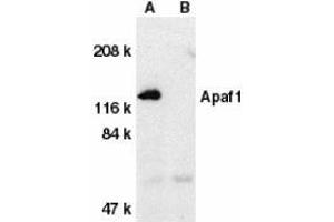 Western blot analysis of Apaf1 in human heart tissue lysate with AP30056PU-N Apaf1 antibody at 1 μg/ml dilution in the absence (A) or presence (B) of blocking peptide.