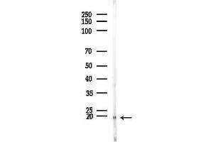anti-Titin-Cap (Telethonin) (TCAP) (N-Term) antibody
