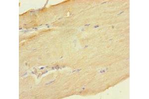 Immunohistochemistry of paraffin-embedded human skeletal muscle tissue using ABIN7149702 at dilution of 1:100 (Deoxyguanosine Kinase 抗体  (AA 40-277))