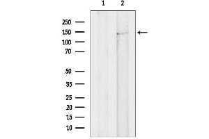 Western blot analysis of lysates from HepG2 cells, using ULK4 Antibody.