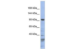 WB Suggested Anti-MYO1C Antibody Titration: 0. (Myosin IC 抗体  (N-Term))