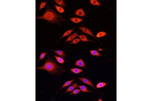 Immunofluorescence (IF) image for anti-serpin Peptidase Inhibitor, Clade A (Alpha-1 Antiproteinase, Antitrypsin), Member 10 (SERPINA10) (AA 165-444) antibody (ABIN1682657)