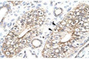 Human kidney; FLJ11730 antibody - N-terminal region in Human kidney cells using Immunohistochemistry (MEAF6 抗体  (N-Term))