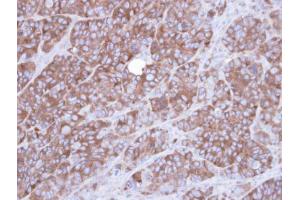 IHC-P Image Immunohistochemical analysis of paraffin-embedded SW480 xenograft , using Alpha-actinin 1, antibody at 1:100 dilution. (ACTN1 抗体)