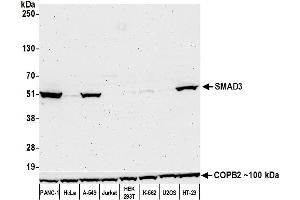 Western Blotting (WB) image for anti-SMAD, Mothers Against DPP Homolog 3 (SMAD3) (AA 200-250) antibody (ABIN7449661)
