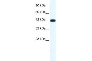 WB Suggested Anti-SLC2A4RG Antibody Titration: 0. (SLC2A4RG 抗体  (Middle Region))