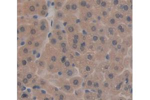 IHC-P analysis of liver tissue, with DAB staining. (TAT 抗体  (AA 190-454))