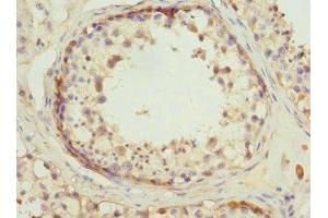 Immunohistochemistry of paraffin-embedded human testis tissue using ABIN7142076 at dilution of 1:100 (RDH5 抗体  (AA 24-318))