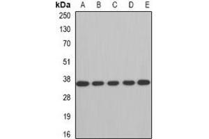 Western blot analysis of AUH expression in A549 (A), SW480 (B), mouse brain (C), mouse kidney (D), rat heart (E) whole cell lysates. (AUH 抗体)