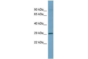 WB Suggested Anti-HOXD1 Antibody Titration: 0. (HOXD1 抗体  (Middle Region))