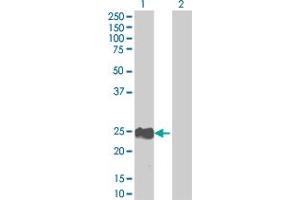 Western Blot analysis of RAB22A expression in transfected 293T cell line by RAB22A MaxPab polyclonal antibody. (RAB22A 抗体  (AA 1-194))