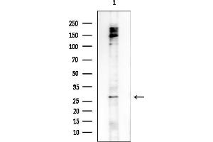 anti-Family with Sequence Similarity 3, Member B (FAM3B) (C-Term) antibody