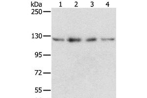 Western Blot analysis of Huvec, hepg2, 293T and A549 cell using RBM5 Polyclonal Antibody at dilution of 1:500 (RBM5 抗体)