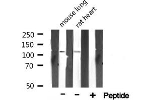 Western blot analysis on various tissue lysate using TAF4 Antibody. (TAF4 抗体)