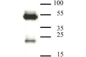 CAF-1 p60 antibody (mAb) tested by Western blot. (CHAF1B 抗体)