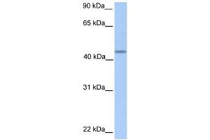 WB Suggested Anti-PNPLA5 Antibody Titration:  0. (PNPLA5 抗体  (C-Term))