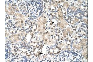 PSAT1 antibody was used for immunohistochemistry at a concentration of 4-8 ug/ml. (PSAT1 抗体  (N-Term))