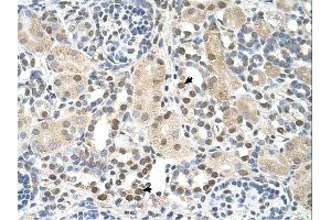 PSAT1 antibody was used for immunohistochemistry at a concentration of 4-8 ug/ml. (PSAT1 抗体  (N-Term))