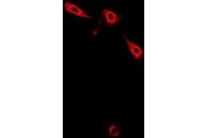 Immunofluorescent analysis of Pinch-1 staining in A549 cells. (LIMS1 抗体)