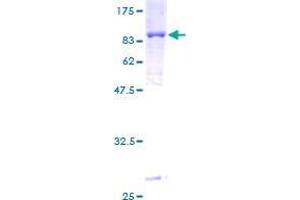 T-Box 22 Protein (TBX22) (AA 1-520) (GST tag)