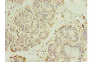 Immunohistochemistry (IHC) image for anti-Ring Finger Protein 26 (RNF26) (AA 246-433) antibody (ABIN7151184)
