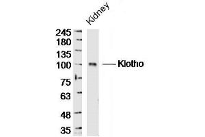 Mouse kidney lysates probed with Klotho Polyclonal Antibody, unconjugated  at 1:300 overnight at 4°C followed by a conjugated secondary antibody at 1:10000 for 90 minutes at 37°C. (Klotho 抗体  (AA 401-500))