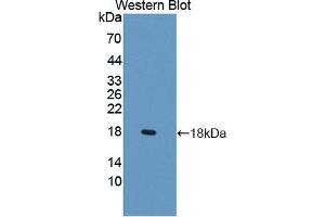 Detection of Recombinant LCNL1, Rat using Polyclonal Antibody to Lipocalin Like Protein 1 (LCNL1) (LCNL1 抗体)