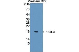 Detection of Recombinant LCNL1, Rat using Polyclonal Antibody to Lipocalin Like Protein 1 (LCNL1) (LCNL1 抗体)