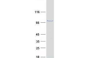 Validation with Western Blot