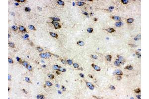 Immunohistochemistry (IHC) image for anti-Chaperonin Containing TCP1, Subunit 4 (Delta) (CCT4) (AA 452-539) antibody (ABIN4886514)